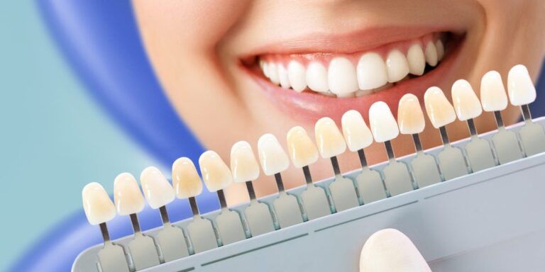 best teeth whitening services in Gurgaon