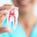 Root-Canal-Treatment in gurugram