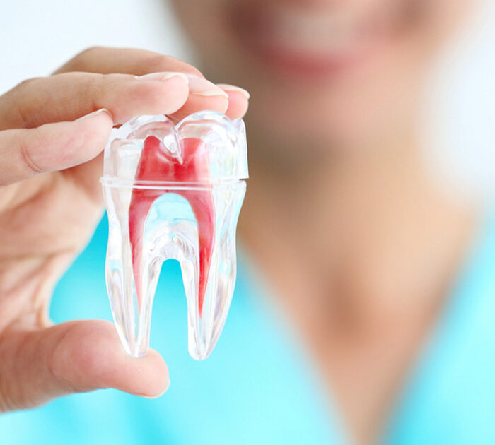 Root-Canal-Treatment in gurugram