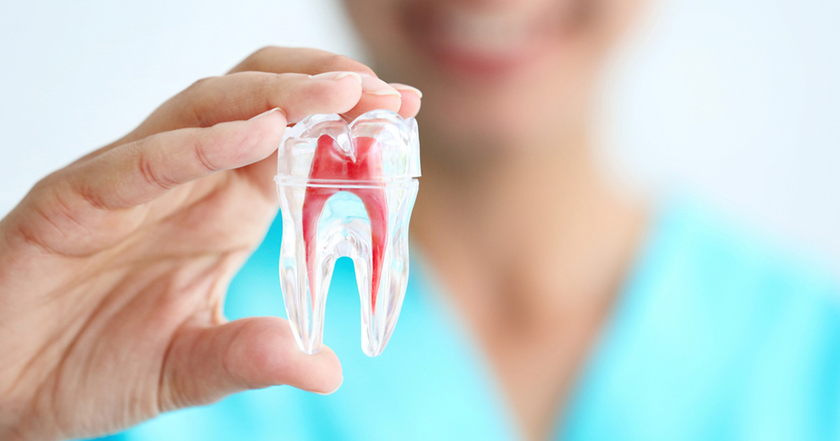 Root-Canal-Treatment in gurugram